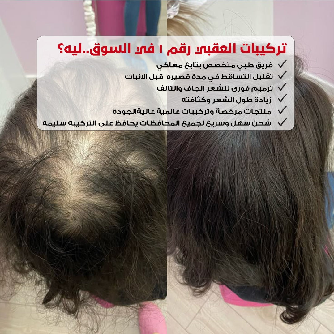 تعبتي من الشعر الجاف والمتساقط؟